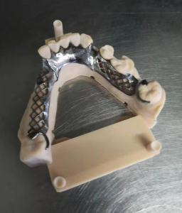 Focus 8.9 Dental 3D Printer