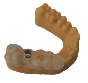 Focus 8.9 Dental 3D Printer